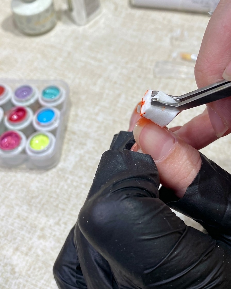 Una mano guantata usa delle pinzette per tamponare gel arancione da una spugnetta sulla punta dellunghia.