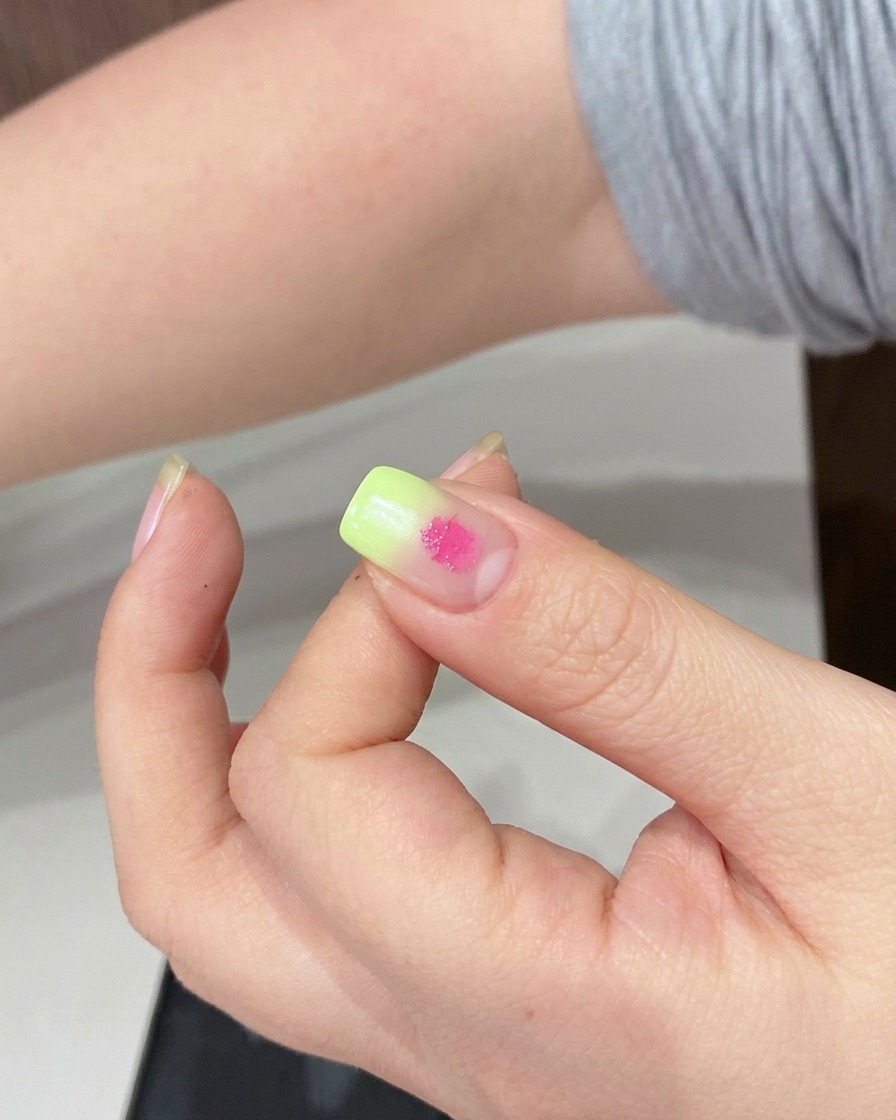 Una spugnetta usata per sfumare il punto di gel rosa sulla superficie dellunghia.