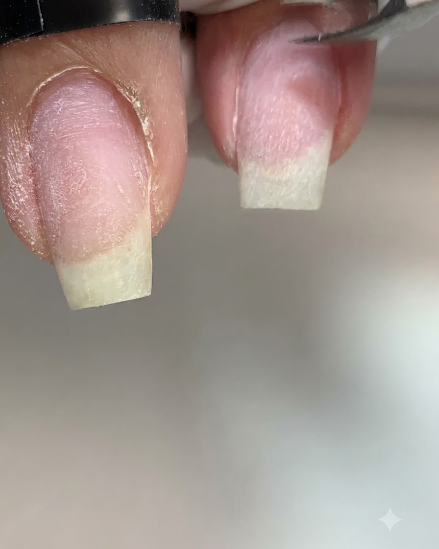 Primo piano di un tronchesino in metallo che taglia con precisione la pelle secca lungo il lato sinistro di ununghia.