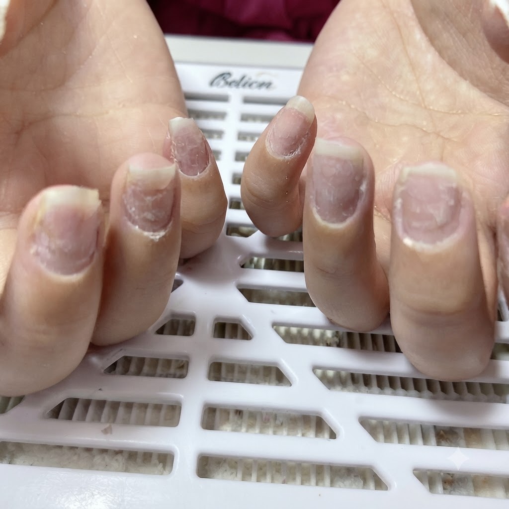 Primo piano di unghie naturali limate a forma a mandorla, con polvere di unghie bianca visibile attorno alle cuticole e ai solchi periungueali.